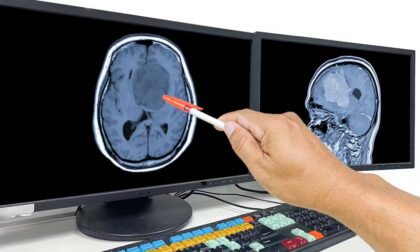 Proche tenant la main d'une personne atteinte d'une tumeur au cerveau en phase terminale