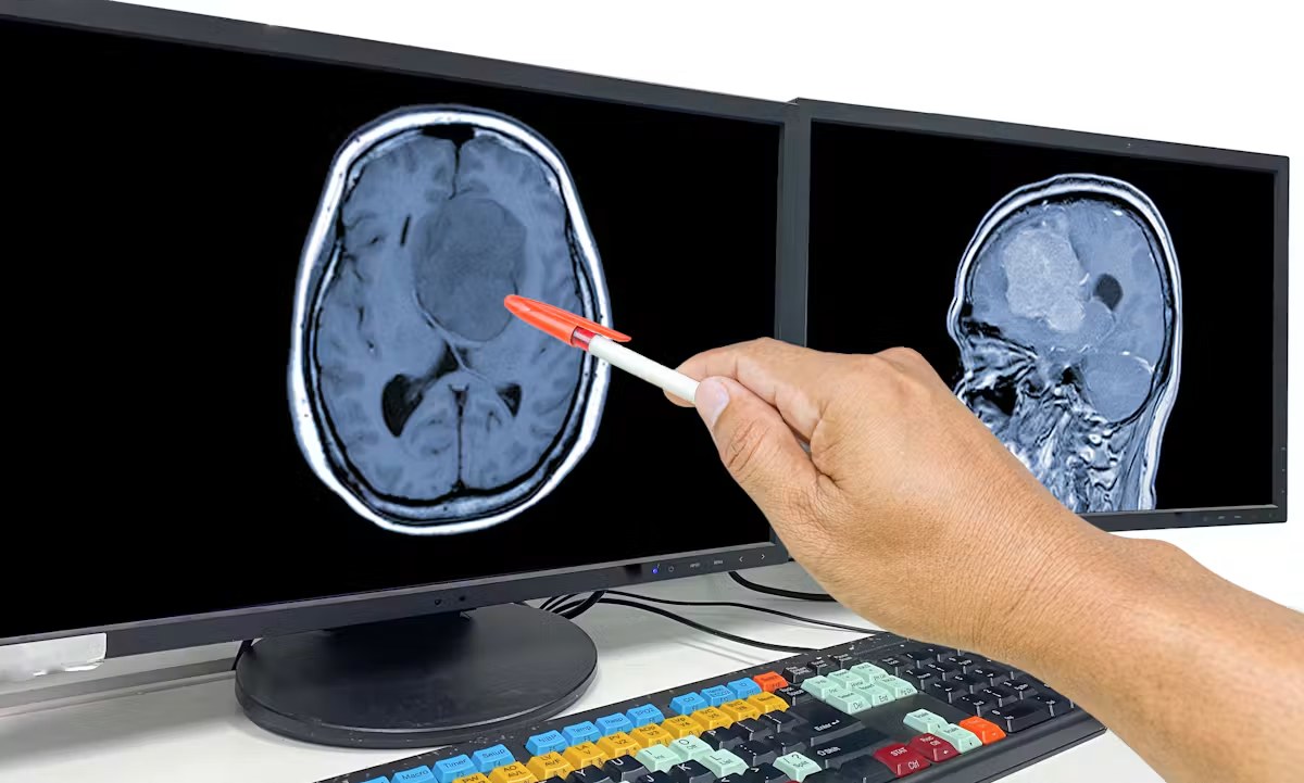 Proche tenant la main d'une personne atteinte d'une tumeur au cerveau en phase terminale