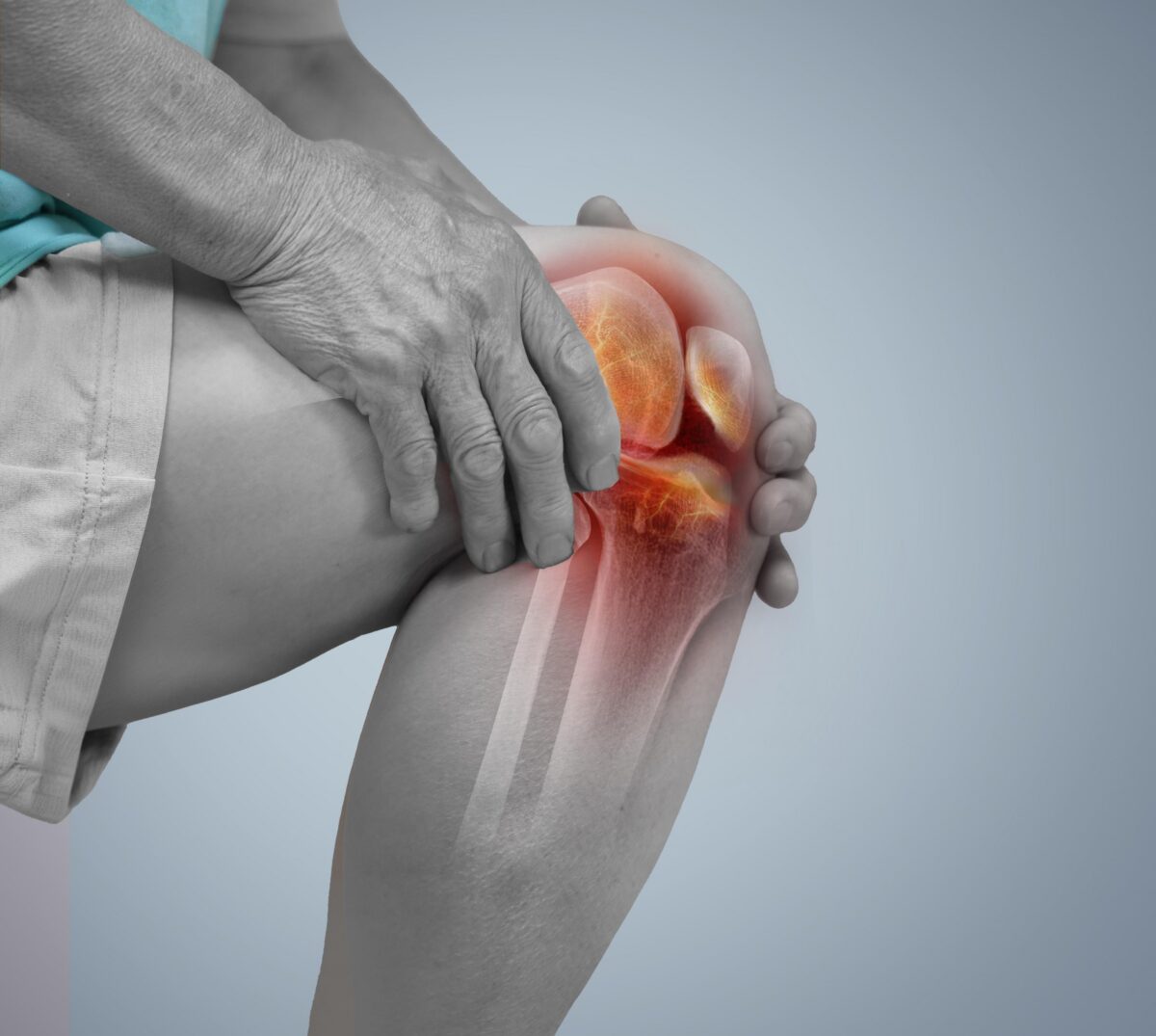 Mains d'une personne atteinte de polyarthrite rhumatoïde aux articulations gonflées